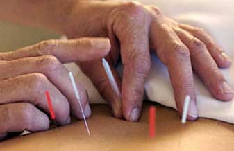 Ângela Michiko Yatabe - Foto 1